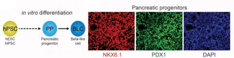 in vitro differentiation - pancreatic progenitors