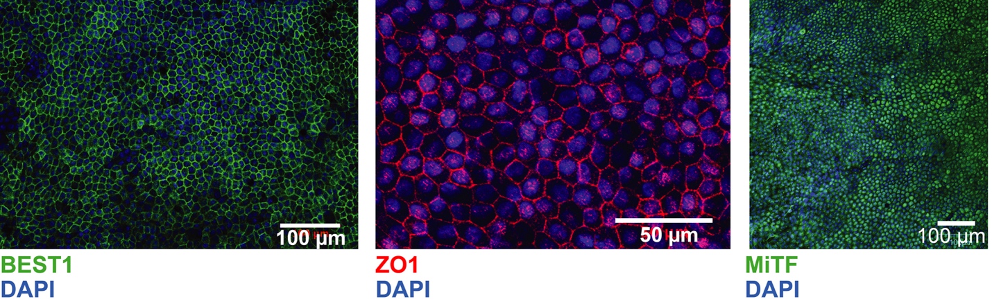 In vitro Differentiation of Human iPSC-derived Retinal Pigment Epithelium Cells 