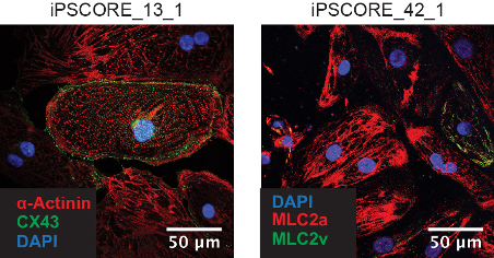 In vitro Differentiation of Human iPSC-derived Cardiovascular Progenitor Cells (iPSC-CVPCs)